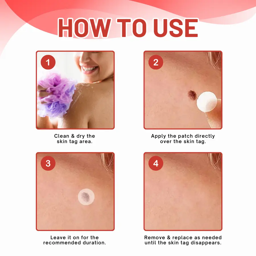 coastglee® MicroDart Skin Tag Remover Patch
