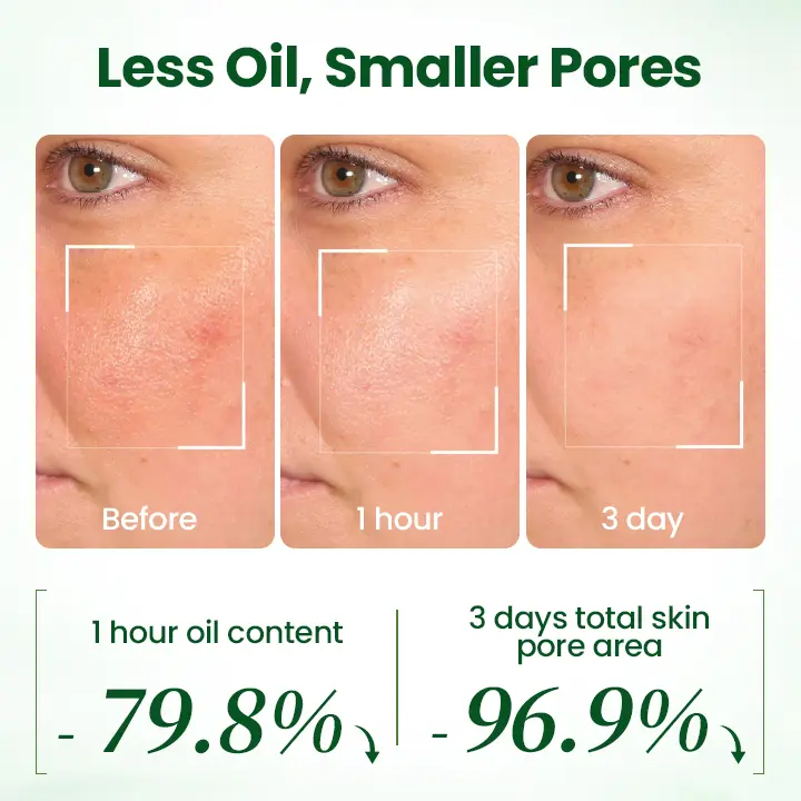 coastglee® PoreMelt Avocado Acid Mask