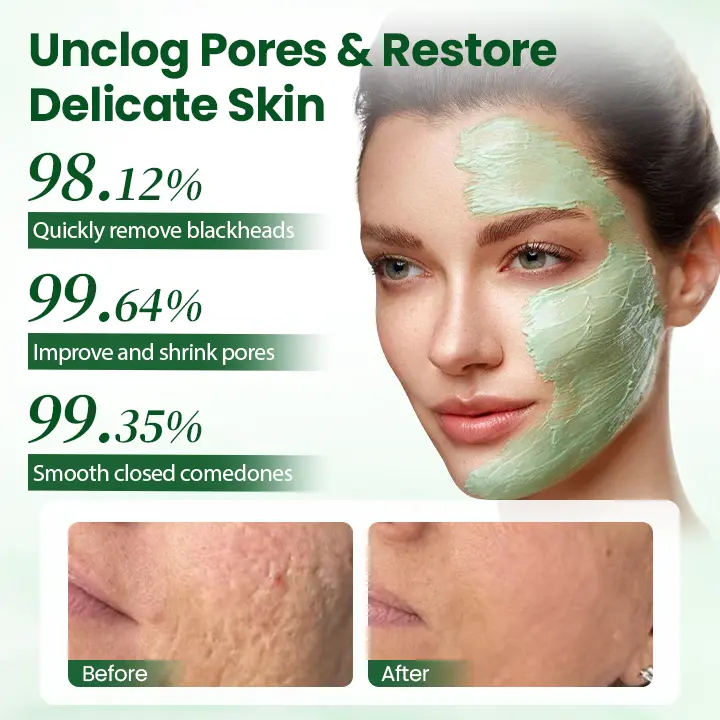 coastglee® PoreMelt Avocado Acid Mask