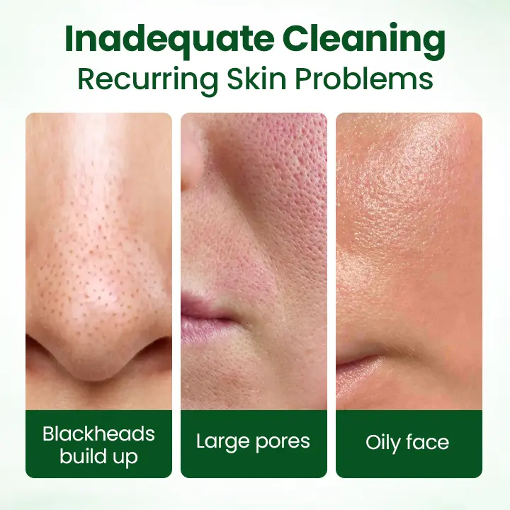 coastglee® PoreMelt Avocado Acid Mask