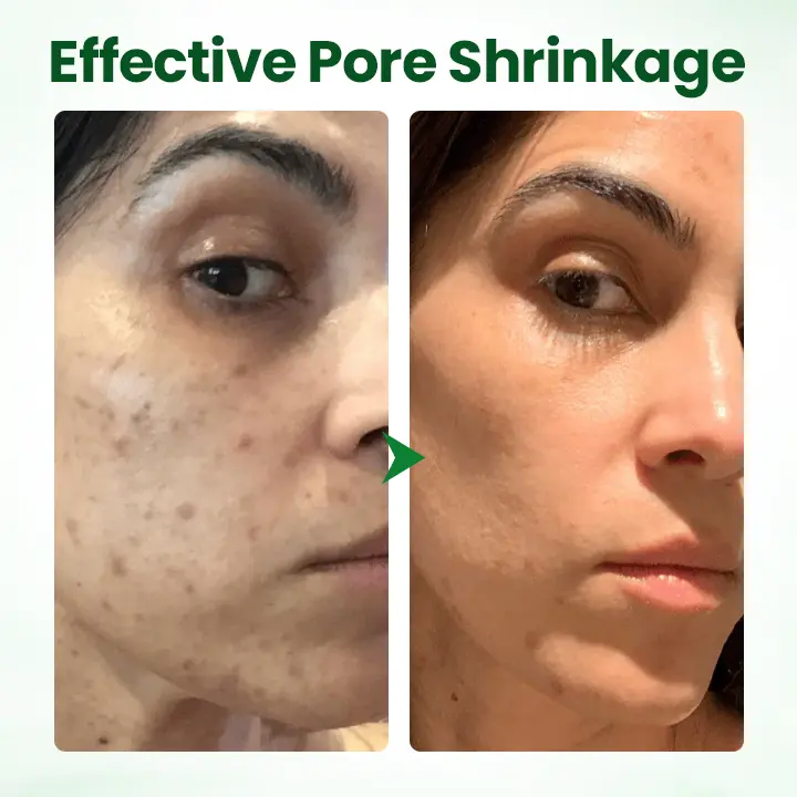 coastglee® PoreMelt Avocado Acid Mask