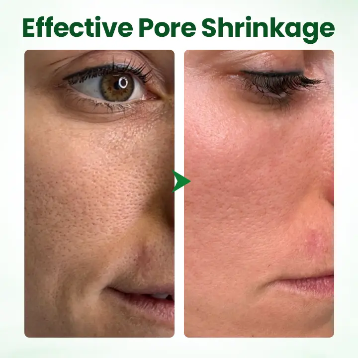 coastglee® PoreMelt Avocado Acid Mask