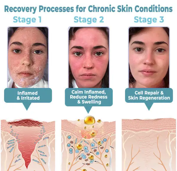 coastglee™ Soothe Tag & Mole Clear Gel (FDA Approved)