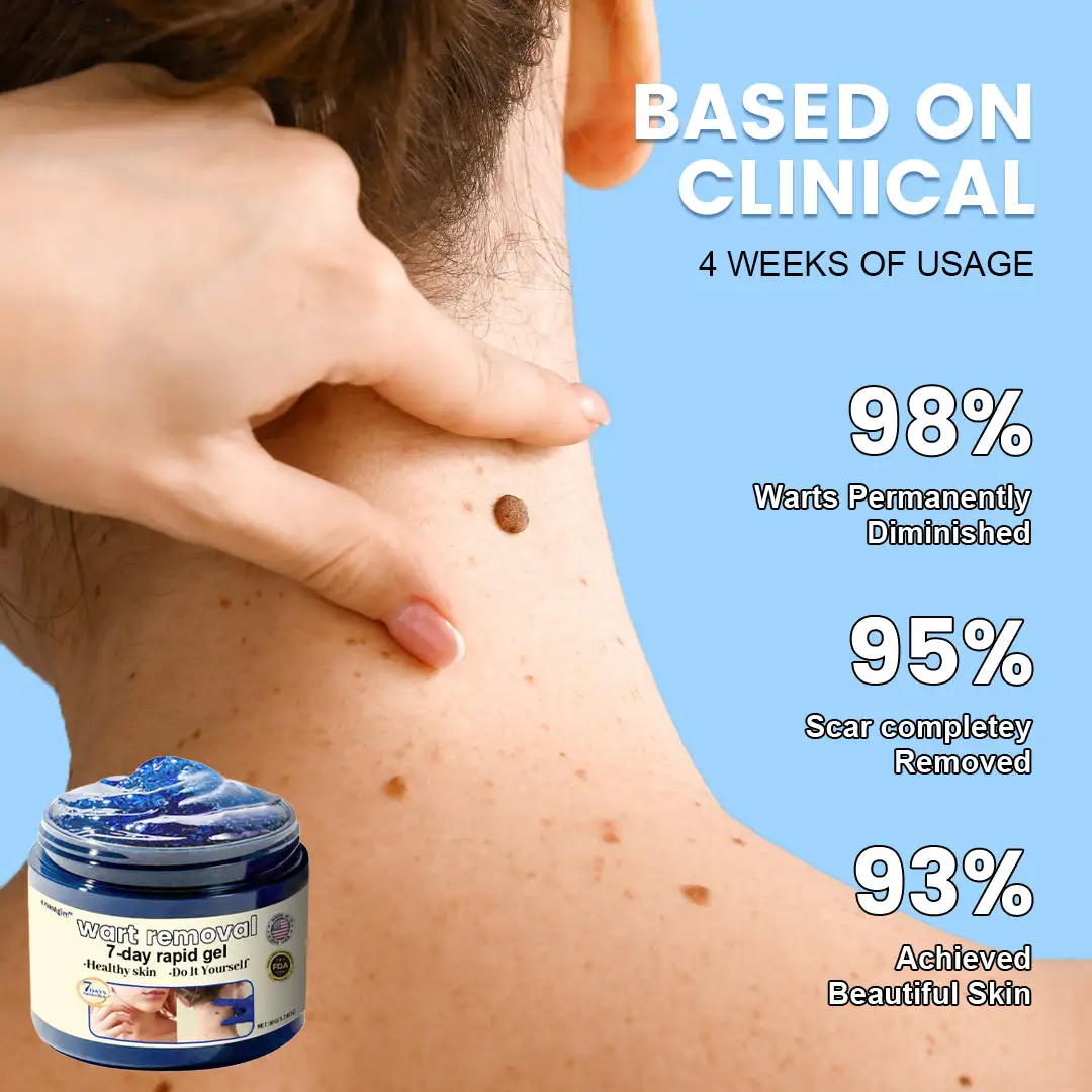 coastglee™7 Day Rapid Wart Removal Gel(U.S. FDA approved)