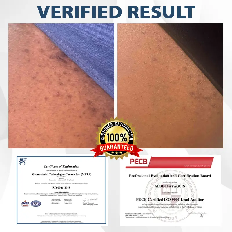 ATTDX® ManGuard HPV Wart Healing Cream