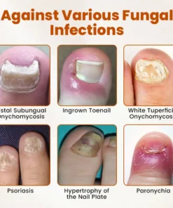 BBOJI™ Bee Toxin Antifungal Drops