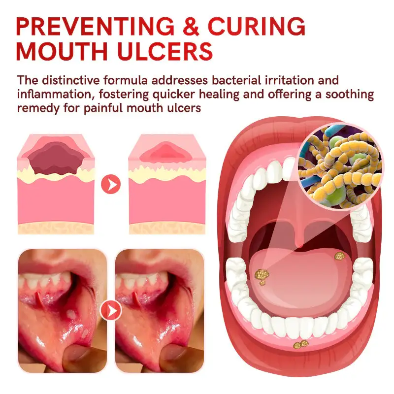 BBOJI™ SP-14 Probiotic Ultra Whitening Toothpaste✅ADA-CERTIFIED & Trusted by Dental Professionals👨⚕️