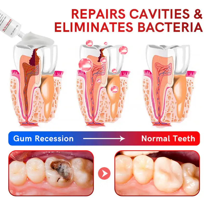BBOJI™ SP-14 Probiotic Ultra Whitening Toothpaste✅ADA-CERTIFIED & Trusted by Dental Professionals👨⚕️