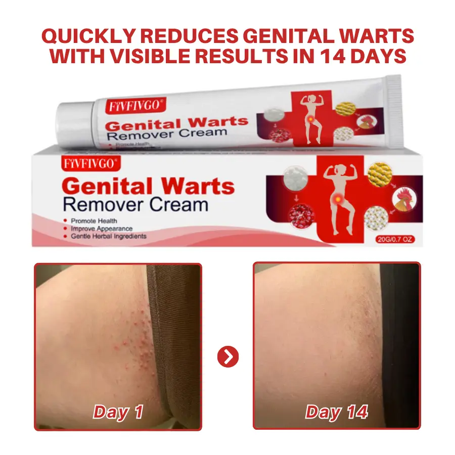 Fivfivgo® FloraGuard HPV Genital Warts Remover