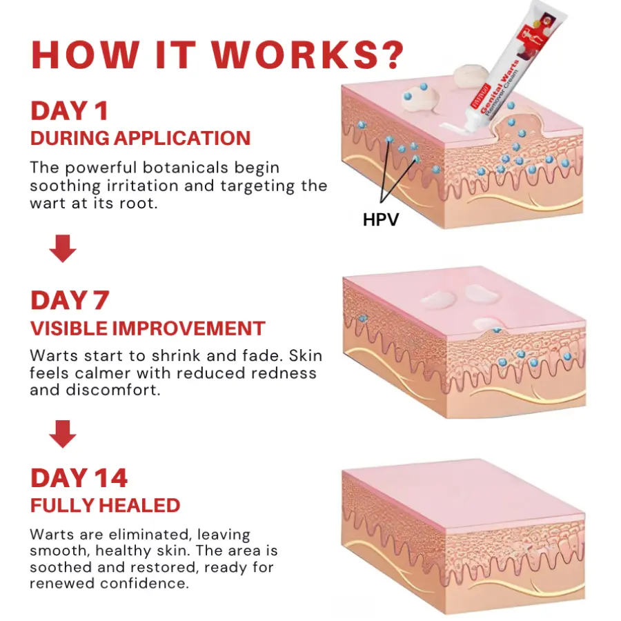 Fivfivgo® FloraGuard HPV Genital Warts Remover