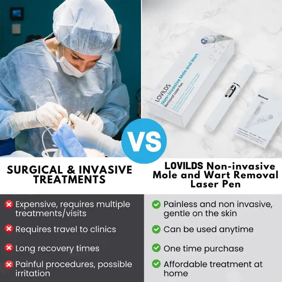 🔥【OFFICIAL STORE】LOVILDS™ Non-Invasive Mole and Wart Removal Laser Pen