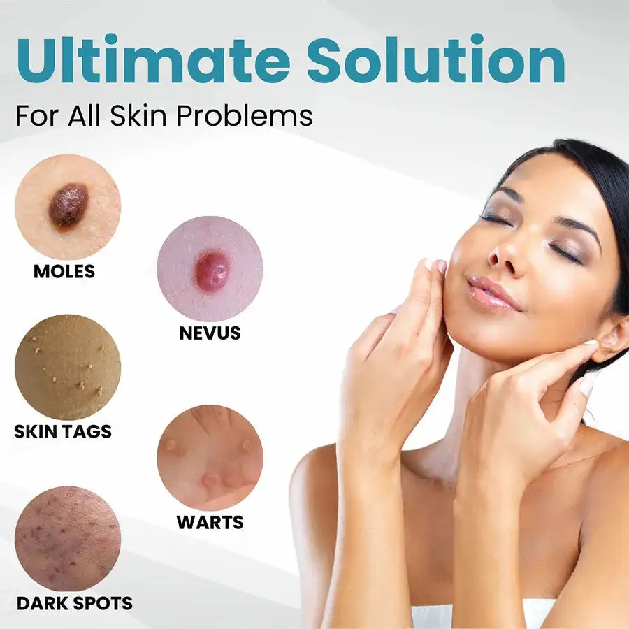 🔥【OFFICIAL STORE】LOVILDS™ Non-Invasive Mole and Wart Removal Laser Pen