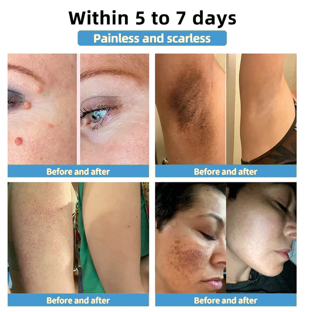 Official Store: coastglee® Bee Toxin Skin Treatment Cream👨⚕️British Academy of Dermatology (BAD) Approved