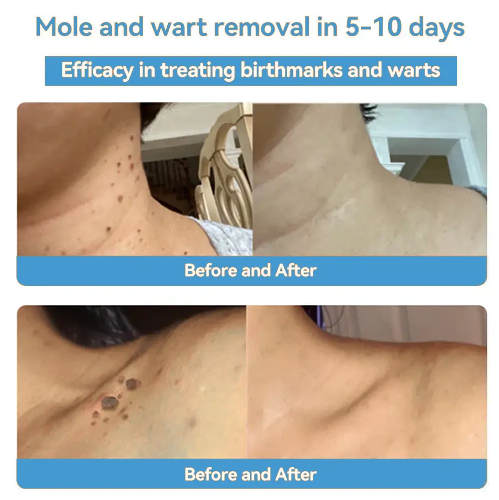 Official Store: coastglee® Bee Toxin Skin Treatment Cream👨⚕️British Academy of Dermatology (BAD) Approved