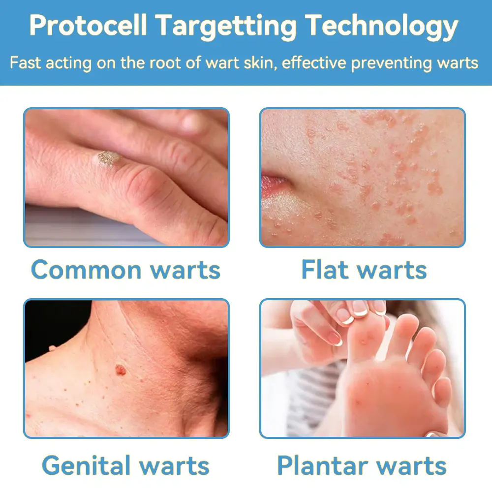 Official Store: coastglee® Bee Toxin Skin Treatment Cream👨⚕️British Academy of Dermatology (BAD) Approved