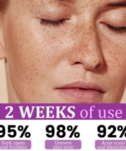 Personana® MelantraX Advanced Anti-Hyperpigmentation Essence(⏰Limited Time Discount⏰)