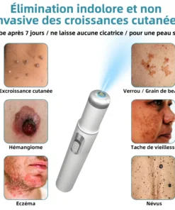 Recommandé par l’ANSM👩‍⚕️𝐤𝐢𝐝𝐬𝐧𝐞𝐞𝐝® 𝐆𝐫𝐚𝐢𝐧𝐬 𝐝𝐞 𝐛𝐞𝐚𝐮𝐭é 𝐞𝐭 𝐯𝐞𝐫𝐫𝐮𝐞𝐬 𝐧𝐨𝐧 𝐢𝐧𝐯𝐚𝐬𝐢𝐟𝐬 𝐒𝐭𝐲𝐥𝐨 𝐥𝐚𝐬𝐞𝐫 𝐝'é𝐥𝐢𝐦𝐢𝐧𝐚𝐭𝐢𝐨𝐧(Élimination rapide et indolore des verrues, grains de beauté, taches de vieillesse et excroissances cutanées — totalement sans effets secondaires)🎉
