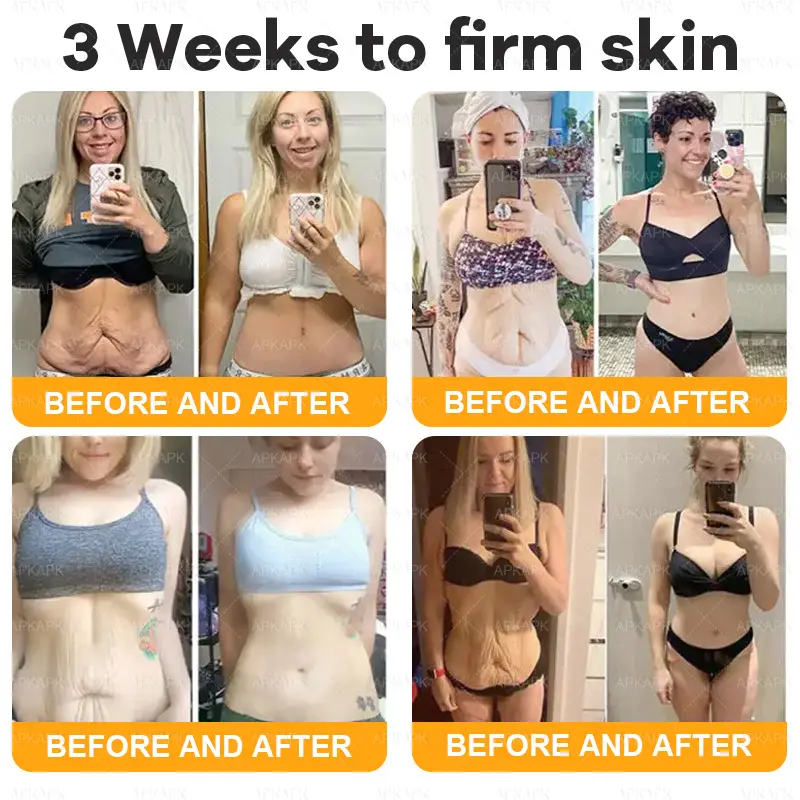 coastglee™ Bee Toxin Skin Regeneration Cream(🧑⚕️AAD Recommended🧑⚕️)