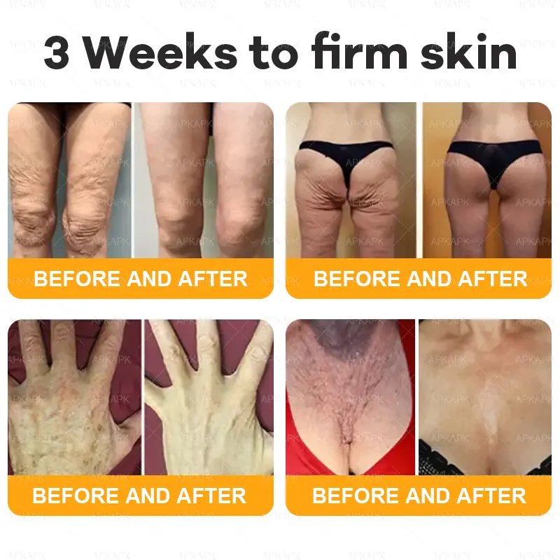 coastglee™ Bee Toxin Skin Regeneration Cream(🧑⚕️AAD Recommended🧑⚕️)