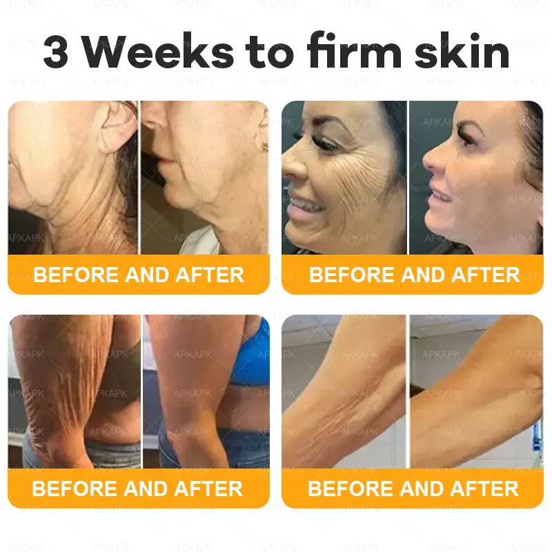 coastglee™ Bee Toxin Skin Regeneration Cream(🧑⚕️AAD Recommended🧑⚕️)