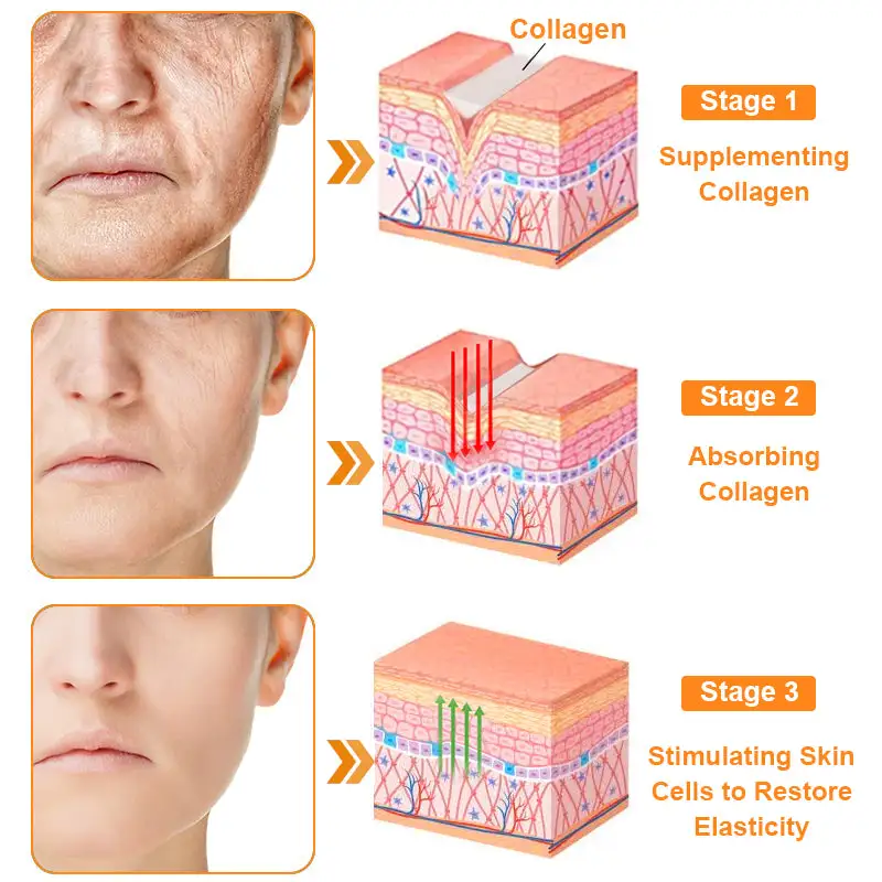 coastglee™ Bee Toxin Skin Regeneration Cream(🧑⚕️AAD Recommended🧑⚕️)