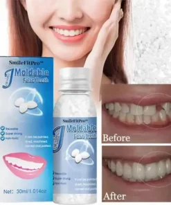 🦷 SmileFitPro™ Dental Filling Gel – Pain-Free, Drill-Free Cavity Solution💖💖