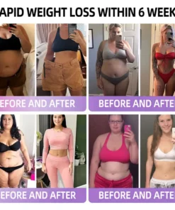 ADFIRE® 👨‍⚕️ Slimming & Appetite Control Probiotic Patch GLP-1 Booster( Fat Burning )