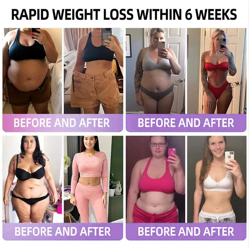 ADFIRE® 👨⚕️ Slimming & Appetite Control Probiotic Patch GLP-1 Booster( Fat Burning )