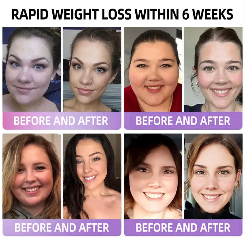 ADFIRE® 👨⚕️ Slimming & Appetite Control Probiotic Patch GLP-1 Booster( Fat Burning )