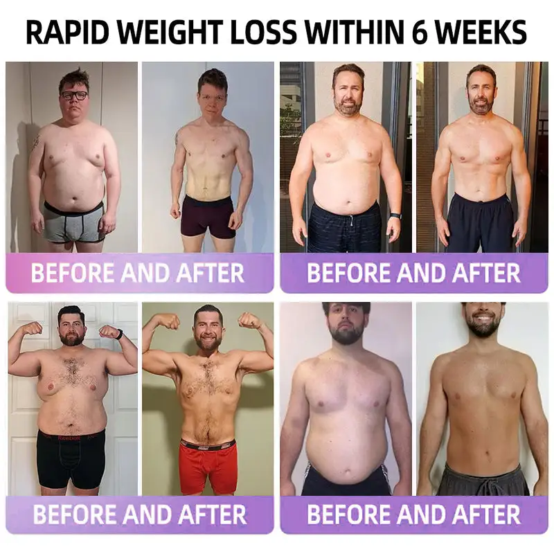 ADFIRE® 👨⚕️ Slimming & Appetite Control Probiotic Patch GLP-1 Booster( Fat Burning )