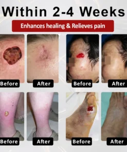 ATTDX® GlucoseGuard Skin Rescue Cream