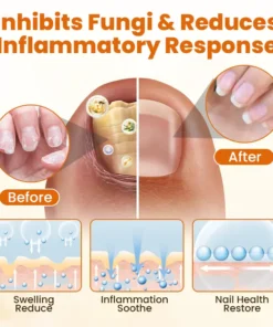 BBOJI™ FungiBee Advanced Nail Repair Spray