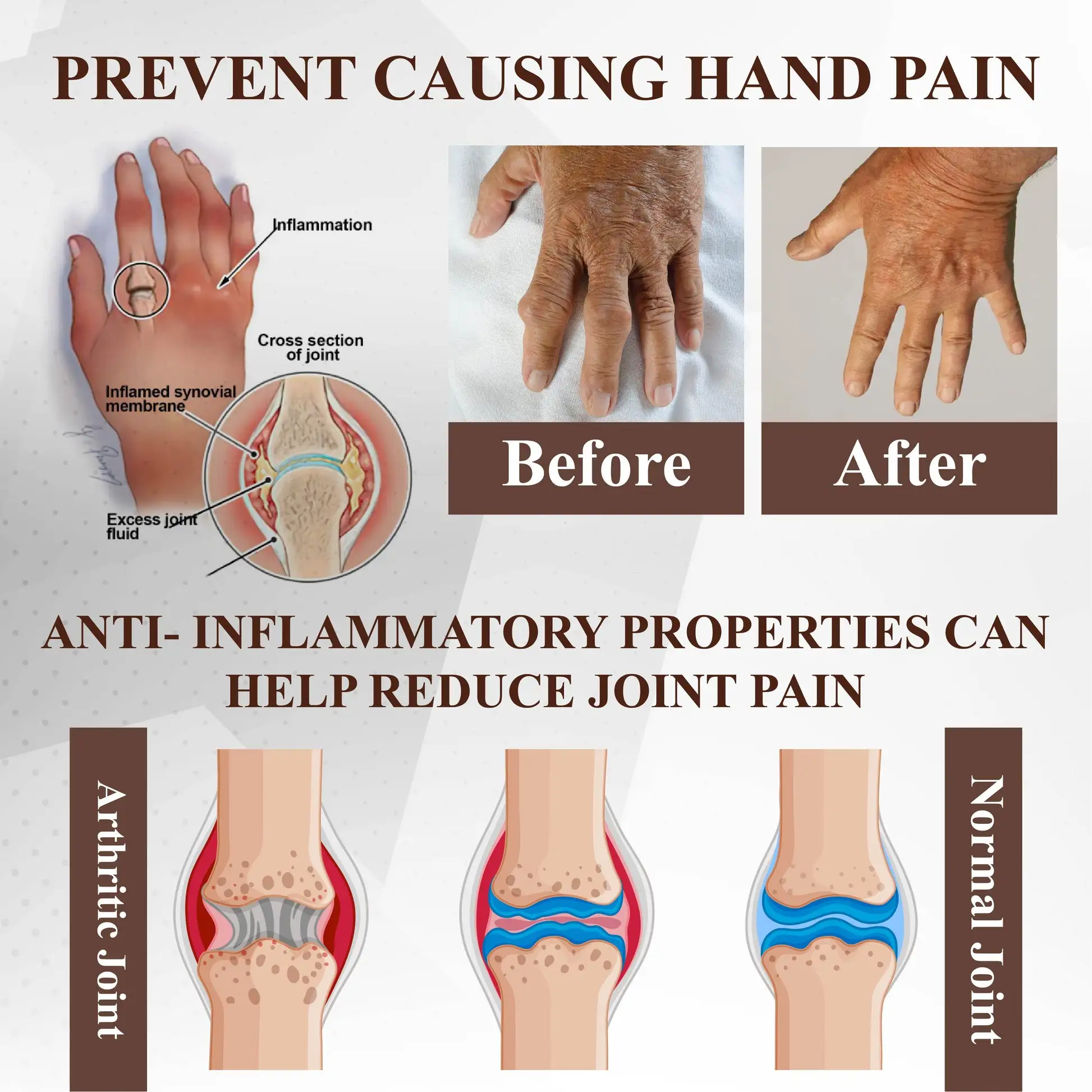 Espre Fòmil Sipò pou Jwenti Bazenith™ MagniBee