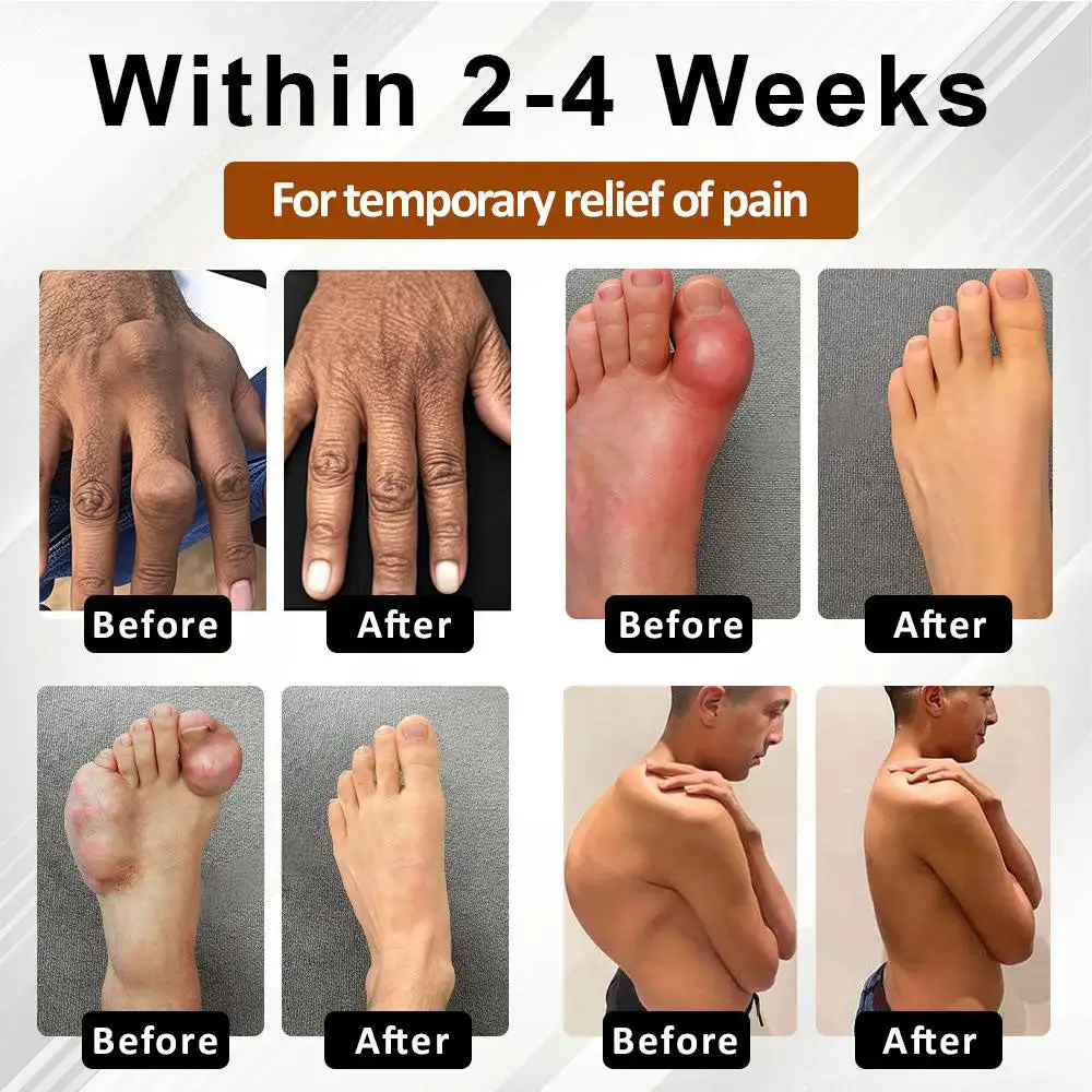 Espre Fòmil Sipò pou Jwenti Bazenith™ MagniBee