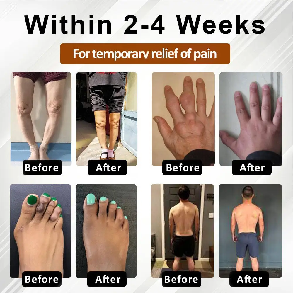 Espre Fòmil Sipò pou Jwenti Bazenith™ MagniBee