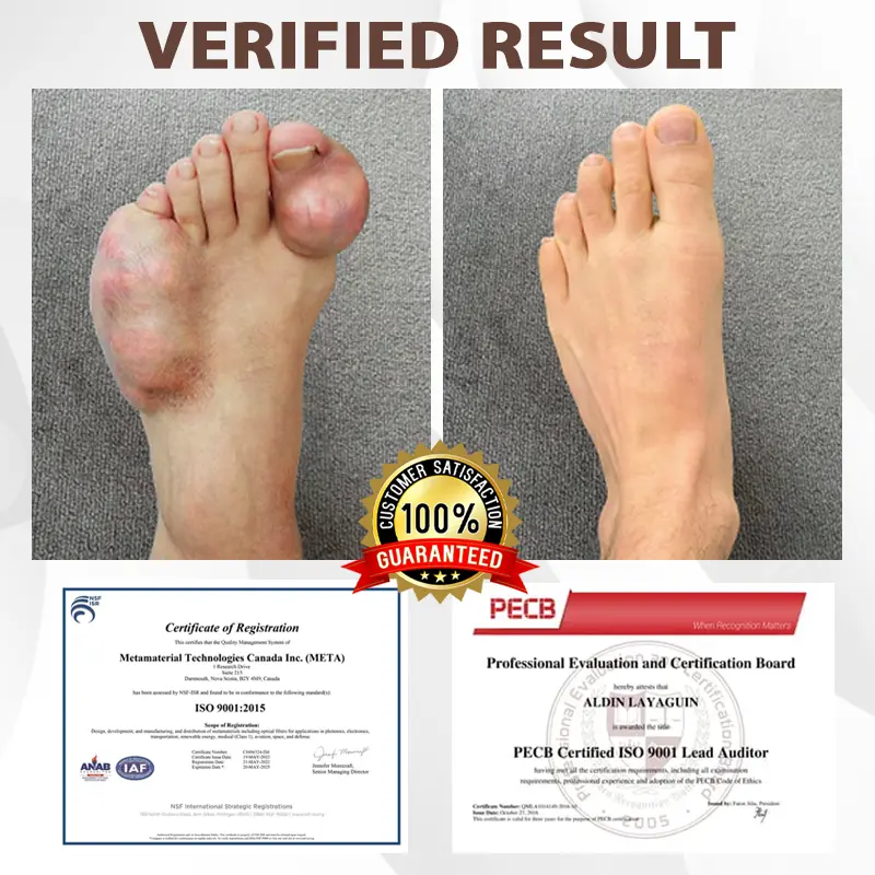 Espre Fòmil Sipò pou Jwenti Bazenith™ MagniBee