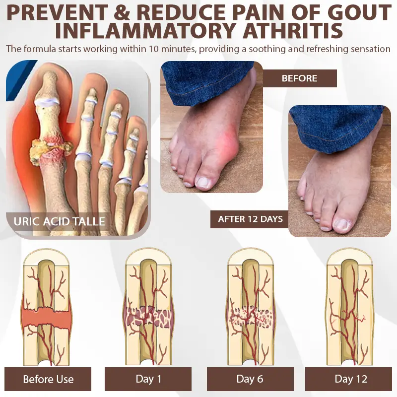 Espre Fòmil Sipò pou Jwenti Bazenith™ MagniBee