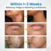 Bikenda® DermaBeam Vitiligo Therapy Device