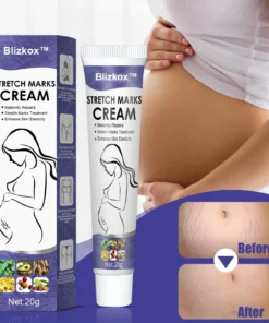 Blizkox ™ Stretch Marks Cream