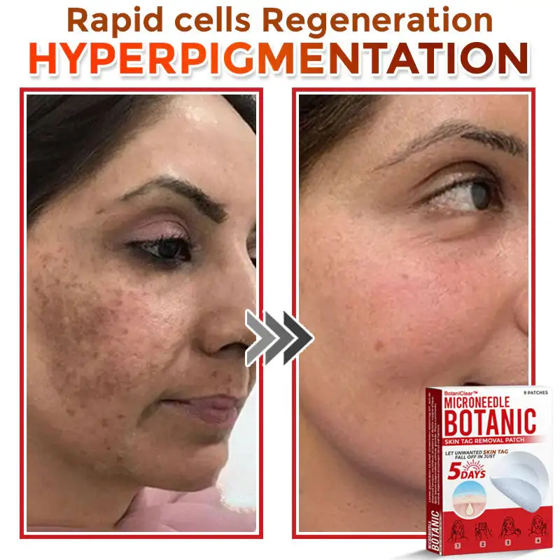 BotaniClear™ USA-Made MicroNeedle Patch