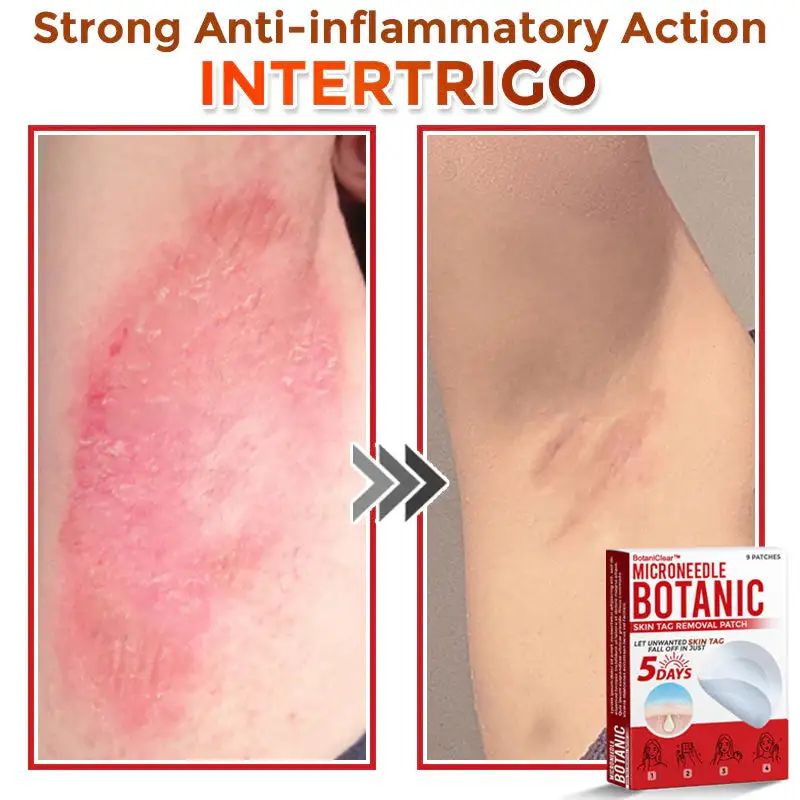 BotaniClear™ USA-Made MicroNeedle Patch