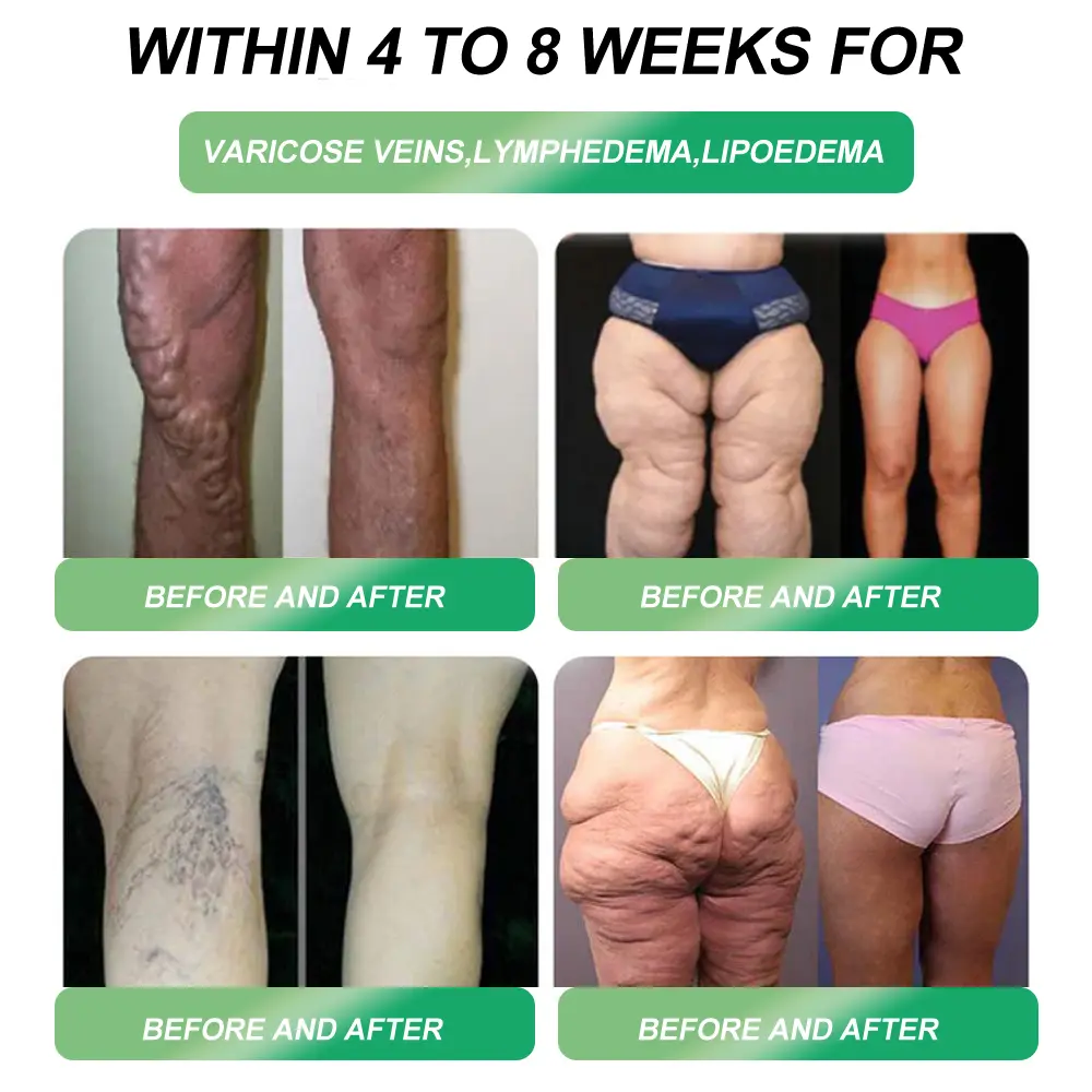 Boinneagan Call Cuideim Croaie® GLP-1