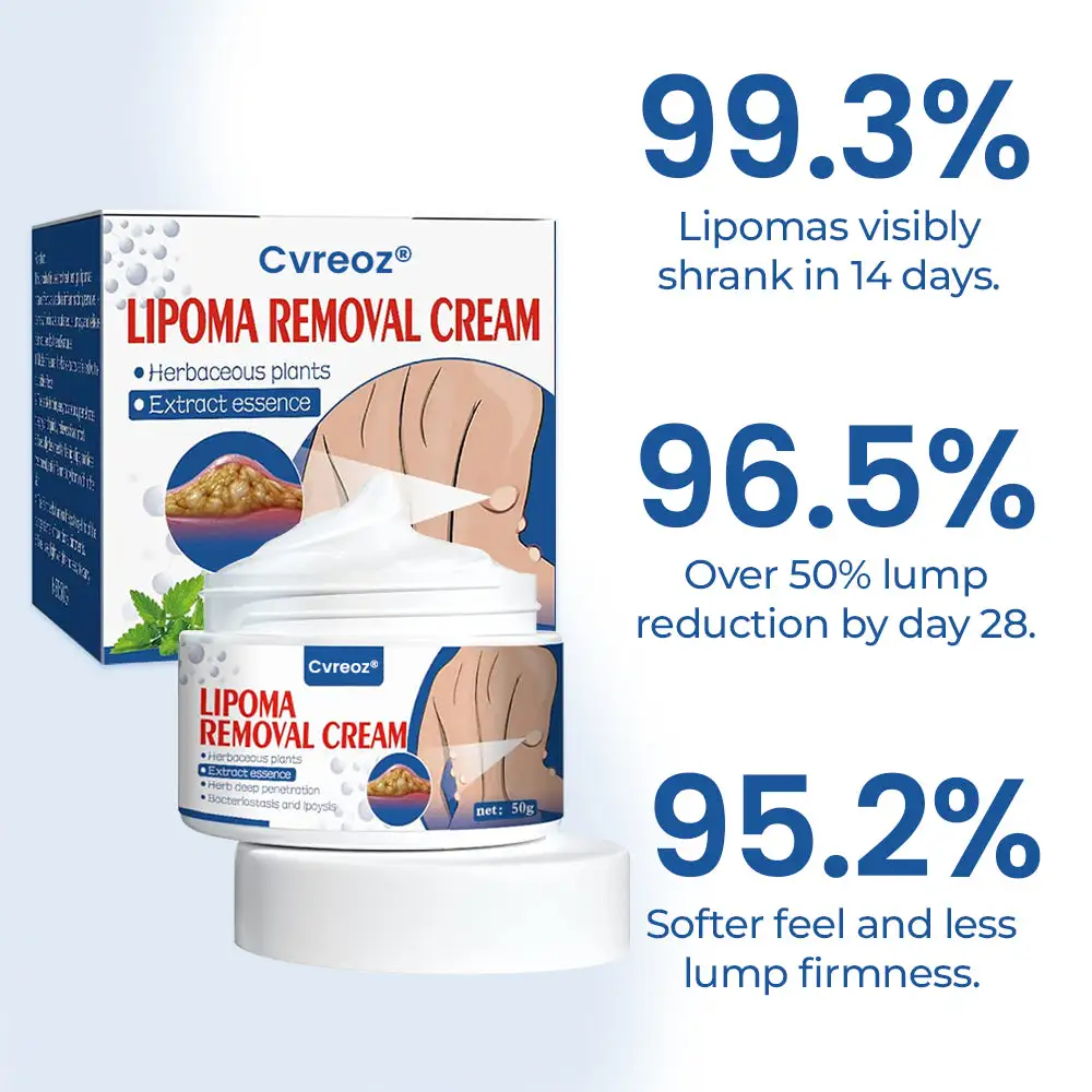 Cvreoz® Lipoma Removal Cream