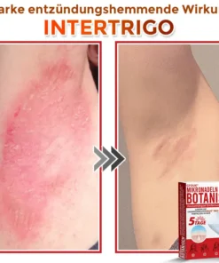 GFOUK® Mikronadeln Botanisch Hautanhängsel Entfernung Patch 🇩🇪 Hergestellt in Deutschland