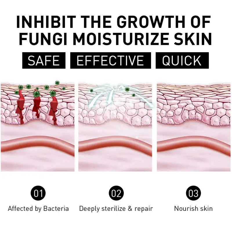 NESLEMY™ Psoriasis Cure Cream