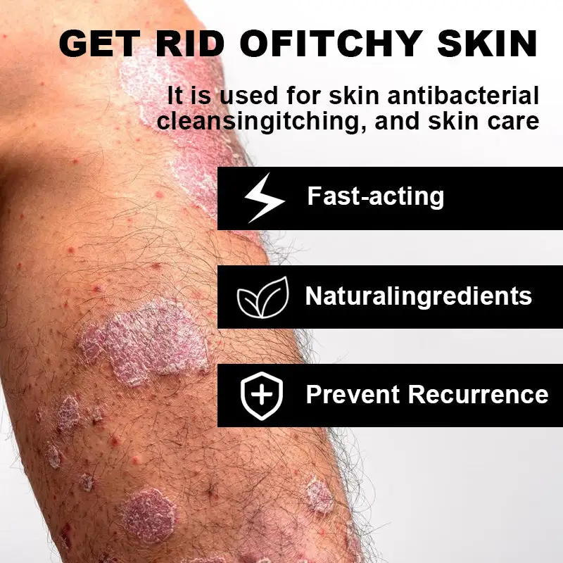 NESLEMY™ Psoriasis Cure Cream