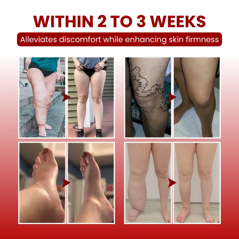 ODALIT ™ SwellCare Advanced Lymphatic Drainage Massage Cream