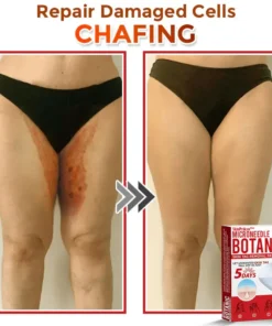 SkinPrikyn™ MicroNeedle Botanic Skin Tag Removal Patch